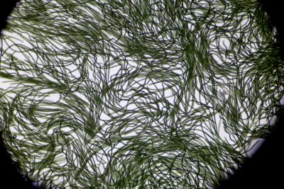 Espirulina vista al microscopio. Foto Martínez Bueso