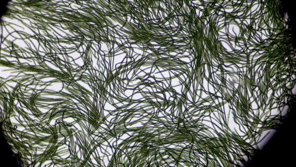 Espirulina vista al microscopio. Foto Martínez Bueso